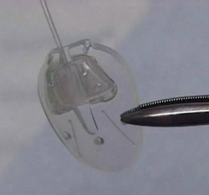 Ahmed Glaucoma Valve used in Aqueous Shunt Implantation